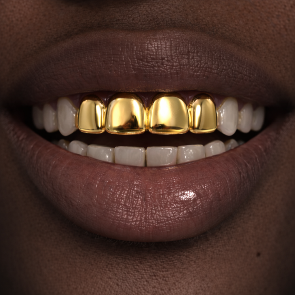 10k Gold Basic Grillz